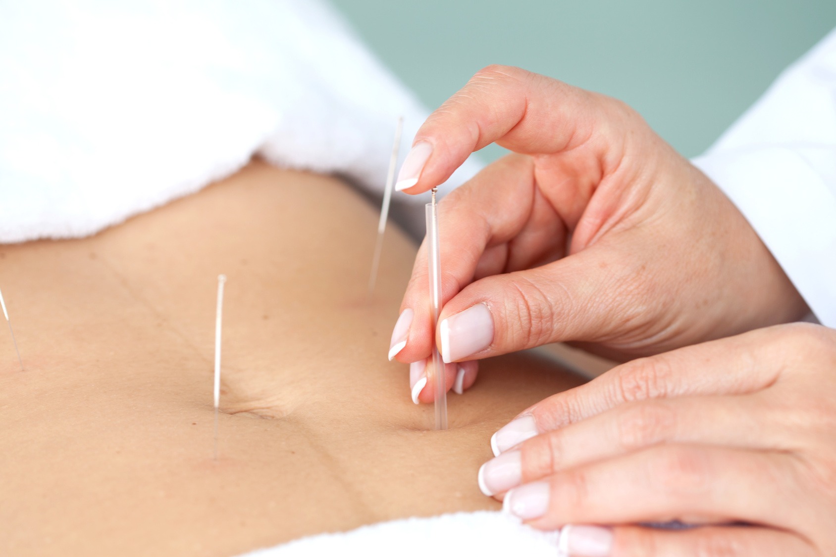 Acupunture and fertility