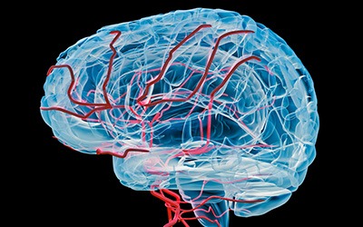 Alzheimer's disease (AD) is primarily a vascular disorder